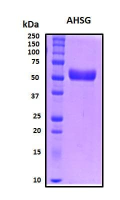 Human AHSG / Fetuin A Protein (Recombinant His, N-Terminal)