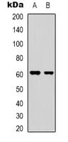 YTHDF1 Antibody (N-Terminus)