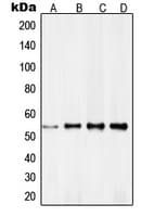 Polyclonal Rabbit anti-Human RXRG Antibody (Internal, IHC, IF, WB)