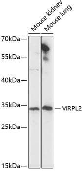 Polyclonal Rabbit anti-Human MRPL2 Antibody (WB)