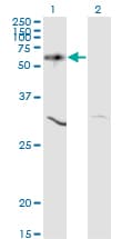 AKT1 Antibody (clone 2E11)
