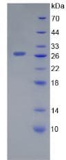 Human LGALS12 / Galectin 12 Protein (Recombinant His, N-Terminal)