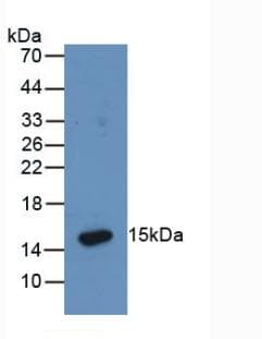 His Tag Antibody