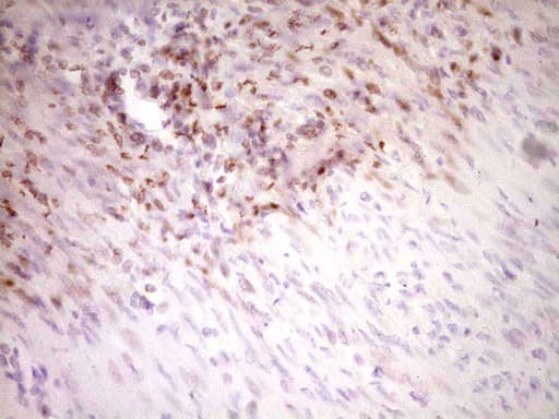 Monoclonal Mouse anti-Human STAB2 / HARE Antibody (clone OTI2A6, aa1914-2194, IHC)