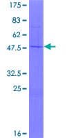 Human MRPL11 Protein (Recombinant GST)
