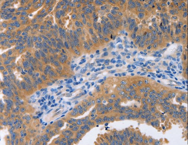Polyclonal Rabbit anti-Human NBEA / Neurobeachin Antibody (IHC)