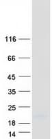 Human SPRR2E Protein (Recombinant Myc-DDK (Flag))
