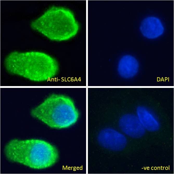 SLC6A4 / SERT Antibody (aa605-618)