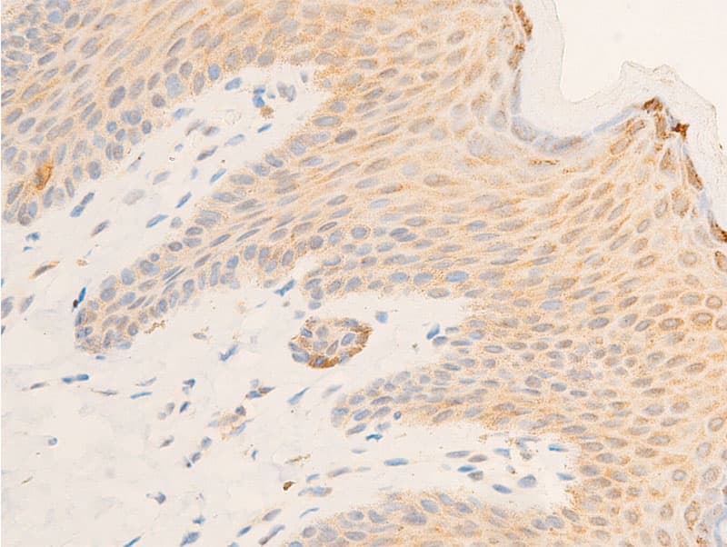 Polyclonal Rabbit anti-Human NFKBIE / IKB Epsilon Antibody (phospho-Ser22, IHC, IF, WB)