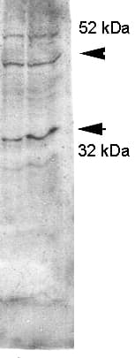 AQP4 / Aquaporin 4 Antibody