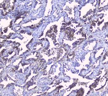 Polyclonal Rabbit anti-Human SRI / Sorcin Antibody (IHC, WB)
