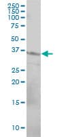 CD79B / CD79 Beta Antibody (clone 4E10-2A10)