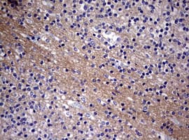 VILIP / VSNL1 Antibody (aa2-191, clone OTI7E12)