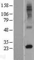 RTP4 / IFRG28 Protein (Over-Expression Lysate Myc-DDK (Flag))