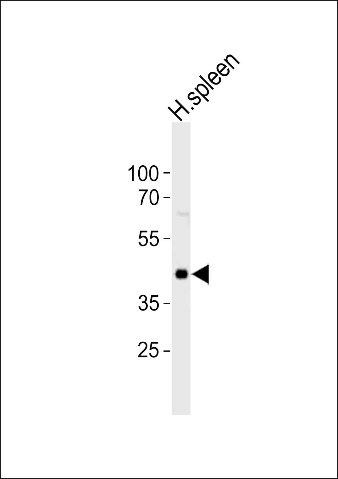 Polyclonal Rabbit anti-Human CHST12 Antibody (aa72-106, WB)