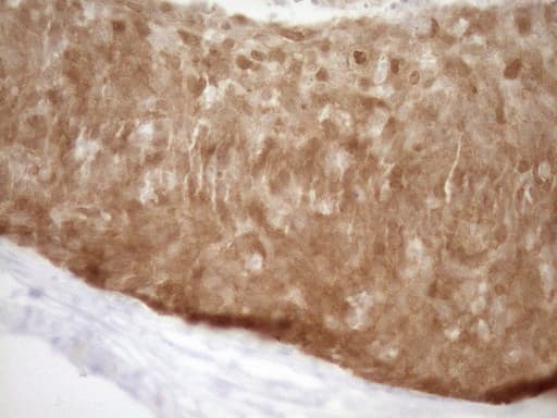 p16INK4a / CDKN2A Antibody (clone OTI7B10)