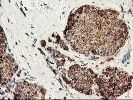 CLPP Antibody (clone OTI1C7)