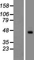 ATCAY / CLAC Protein (Over-Expression Lysate Myc-DDK (Flag))