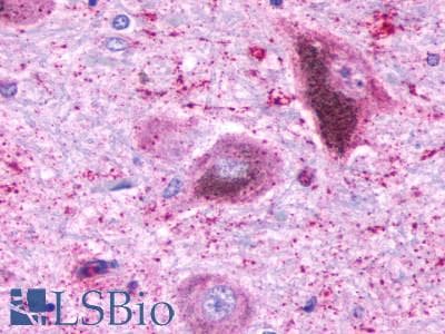 PathPlus™ Polyclonal Rabbit anti-Human NTSR2 / NTR2 Antibody (C-Terminus, IHC)
