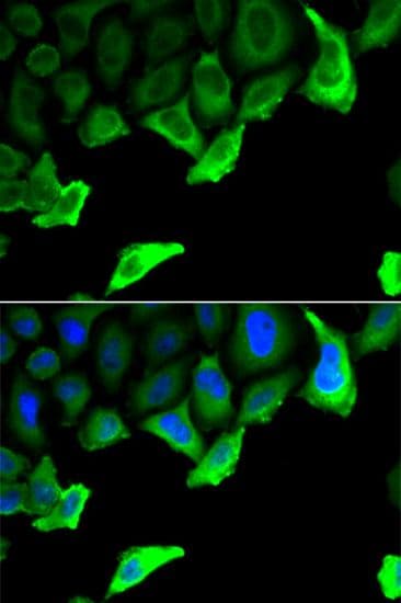 HSP90AA1 / Hsp90 Alpha A1 Antibody