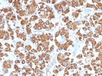 GH / Growth Hormone Antibody (clone GH/1450)