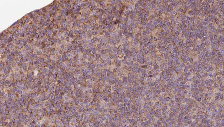 IVD Antibody