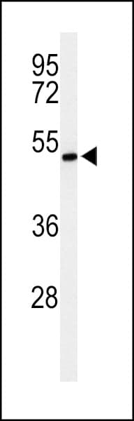 ZDHHC9 Antibody (aa335-364)