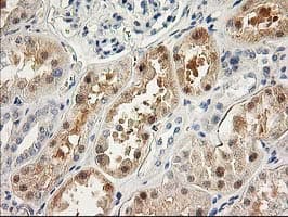 LIMK1 / LIMK Antibody (clone OTI2A11)