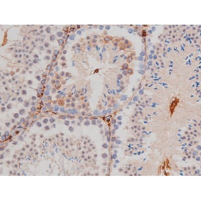 Polyclonal Rabbit anti-Human MAPT / Tau Antibody (phospho-Thr181, IHC, WB)