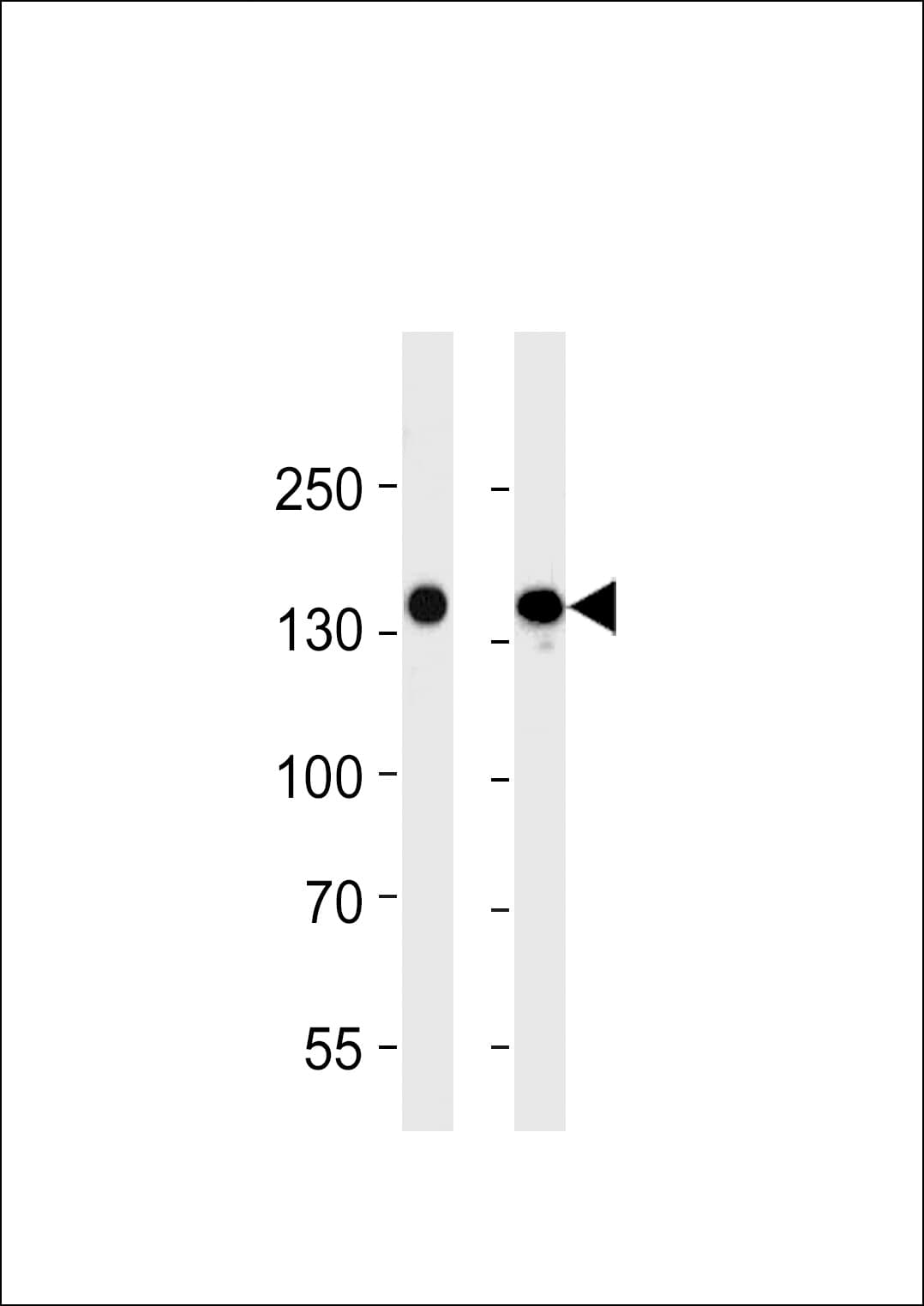 IHC-plus™ Monoclonal Mouse anti-Human FLT4 / VEGFR3 Antibody (clone 818CT12.1.1, IHC, WB)