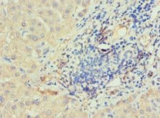 Polyclonal Rabbit anti-Human IRAK2 / IRAK-2 Antibody (aa1-270, IHC)