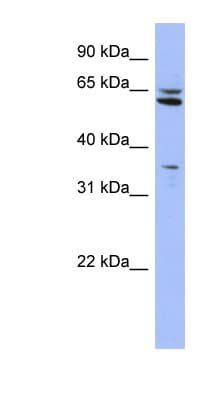 PH4 / P4HTM Antibody (aa215-264)