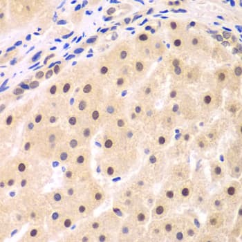 Polyclonal Rabbit anti-Human NFKBIB / IKB Beta / IKBB Antibody (IHC, IF, WB)