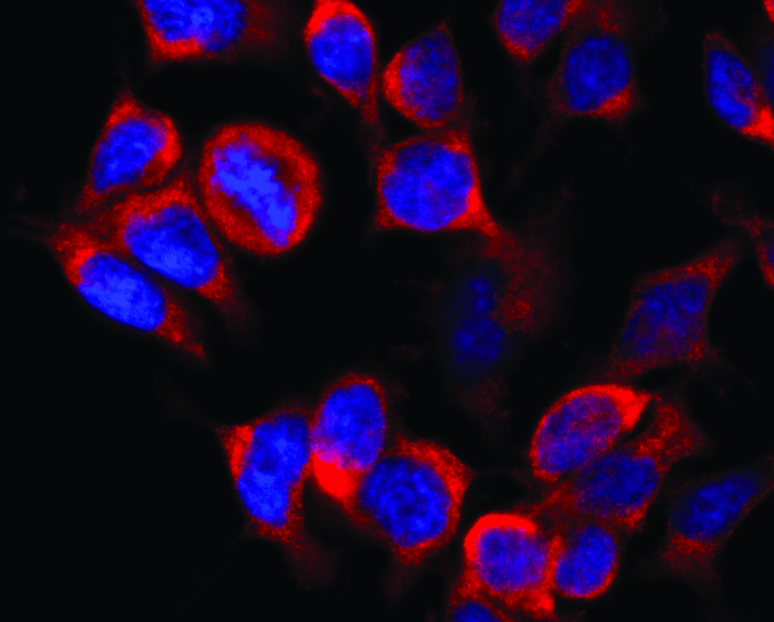 Kinesin Heavy Chain / KIF5B Antibody (clone KN-02)
