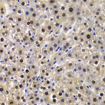QIP1 / KPNA4 Antibody
