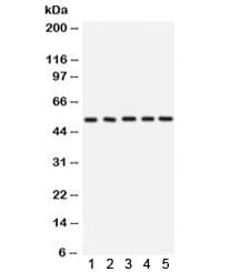 ARSA / Arylsulfatase A Antibody