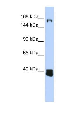 Polyclonal Rabbit anti-Human C10orf12 Antibody (aa1080-1129, WB)