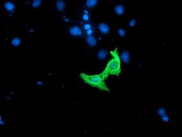 RASSF1 / RASSF1A Antibody (aa1-341, clone 8.00E+04, Carrier-free)