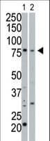 PKG / PRKG1 Antibody (aa629-660)