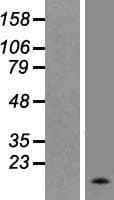 APOC2 / Apolipoprotein C II (Over-Expression Lysate Myc-DDK (Flag))