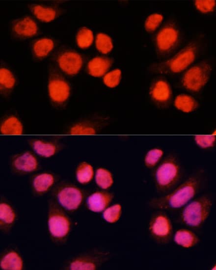 C13orf8 / ZNF828 Antibody