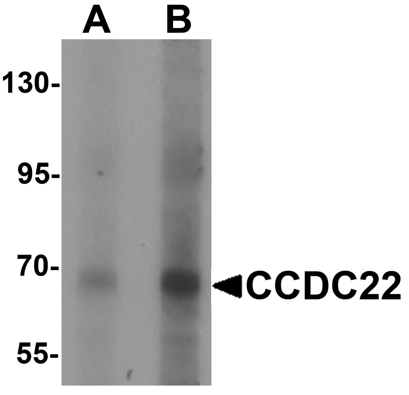 IHC-plus™ CCDC22 Antibody