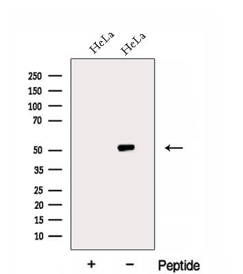Polyclonal Rabbit anti-Human EIF2S3 / EIF2G Antibody (IF, WB)
