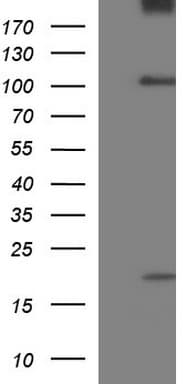 UNC13D Antibody (clone OTI1F4)