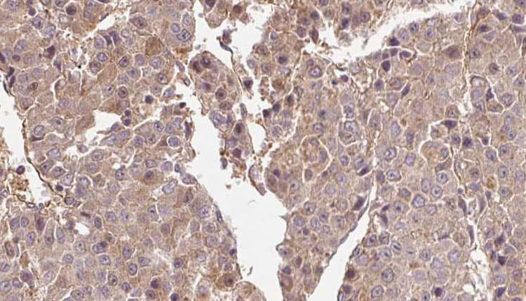 HTR1B / 5-HT1B Receptor Antibody