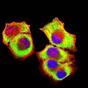 KAT2B / PCAF Antibody (clone 7D12C8)