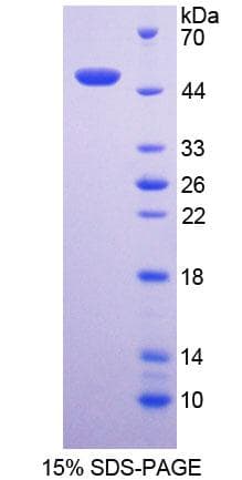 Human NCF1 / p47phox / p47 phox Protein (Recombinant His-T7)