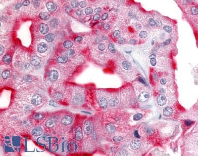 PathPlus™ Polyclonal Rabbit anti-Human CDK12 / CRKRS Antibody (Internal, IHC)