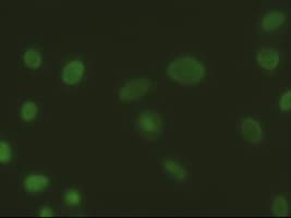 Monoclonal Mouse anti-Human EPCAM Antibody (clone OTI2H9, IF, WB)