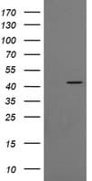 CATIP / C2orf62 Antibody (clone OTI4E1)